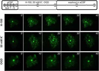 The deletion of AQP4 and TRPV4 affects astrocyte swelling/volume recovery in response to ischemia-mimicking pathologies